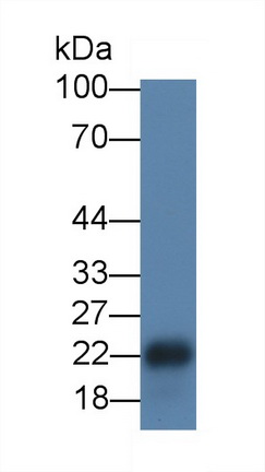 Monoclonal Antibody to Mucin 1 (MUC1)