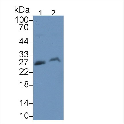 Monoclonal Antibody to Myelin Oligodendrocyte Glycoprotein (MOG)