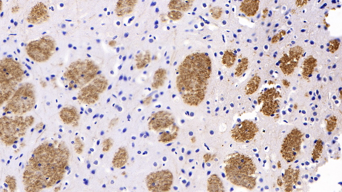 Monoclonal Antibody to Synaptophysin (SYP)