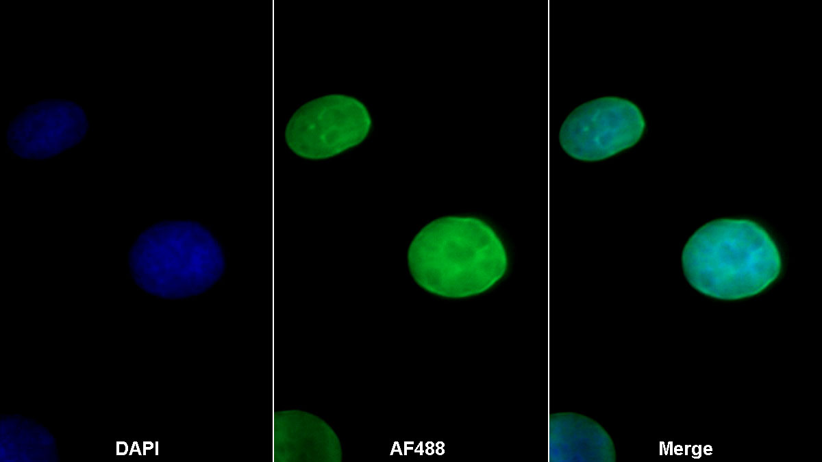 Monoclonal Antibody to Estrogen Receptor Beta (ERb)