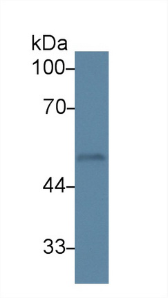 Monoclonal Antibody to Protein Kinase C Epsilon (PKCe)