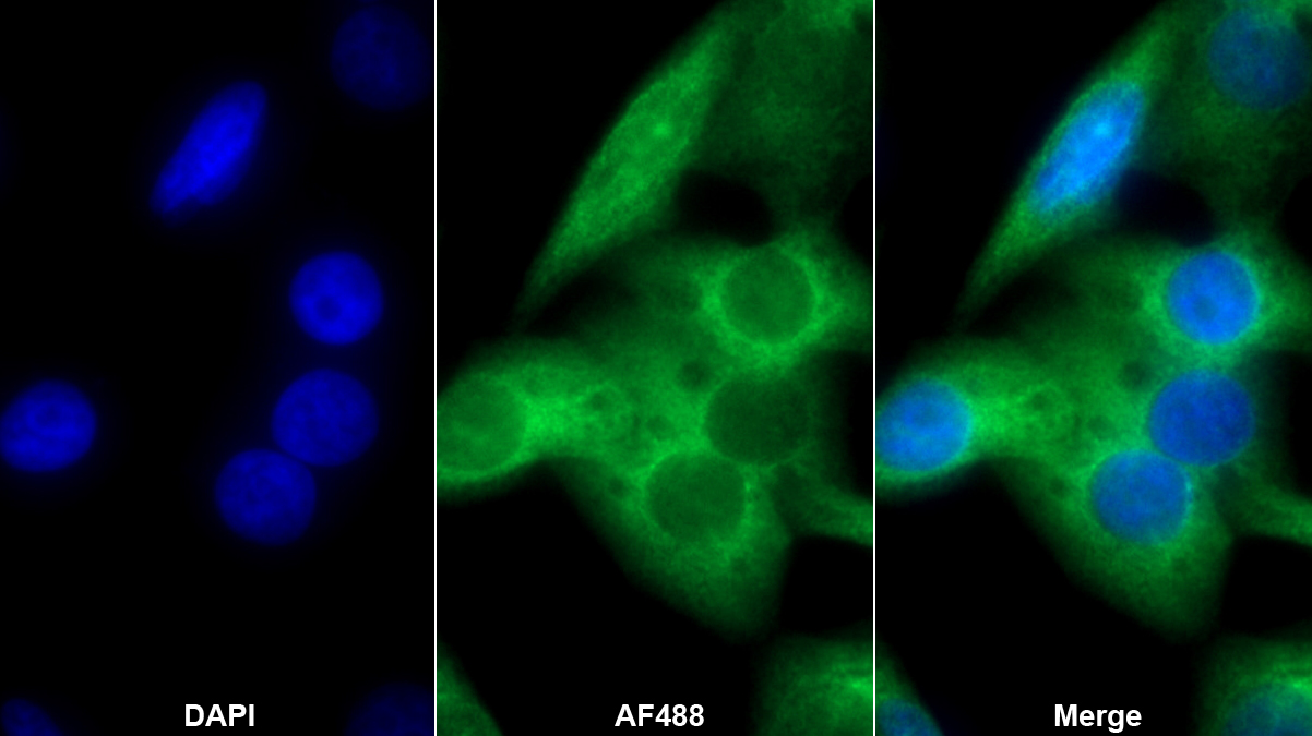 Monoclonal Antibody to Protein Kinase C Epsilon (PKCe)