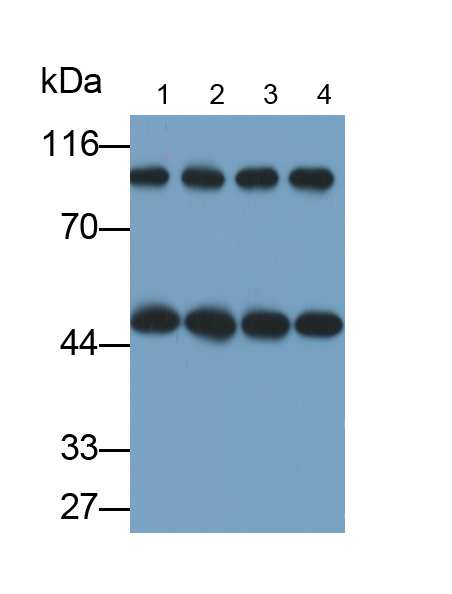 Monoclonal Antibody to Protein Kinase C Epsilon (PKCe)