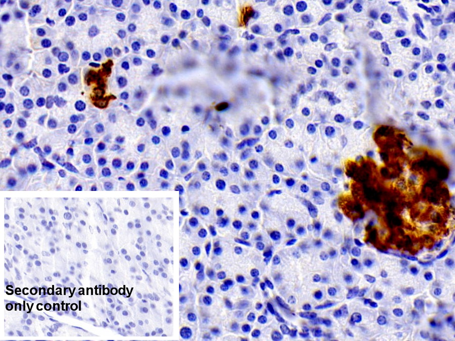 Monoclonal Antibody to Insulin (INS)