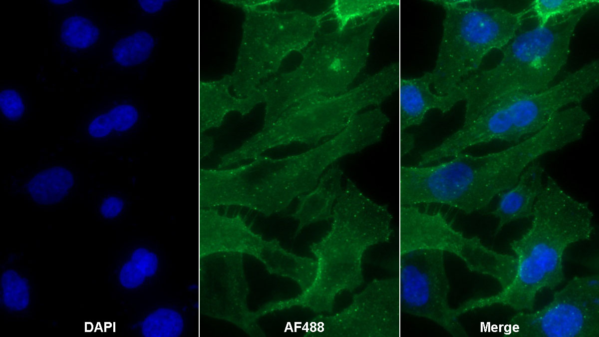 Monoclonal Antibody to Cluster Of Differentiation 55 (CD55)