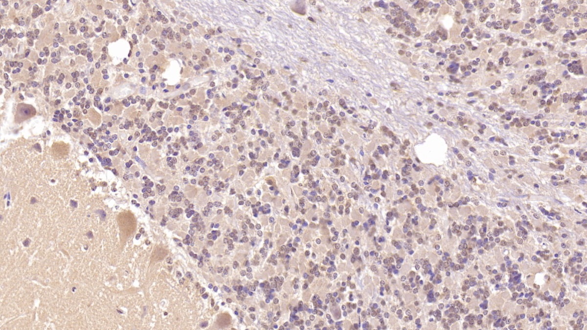 Monoclonal Antibody to Parathyroid Hormone Receptor 2 (PTHR2)