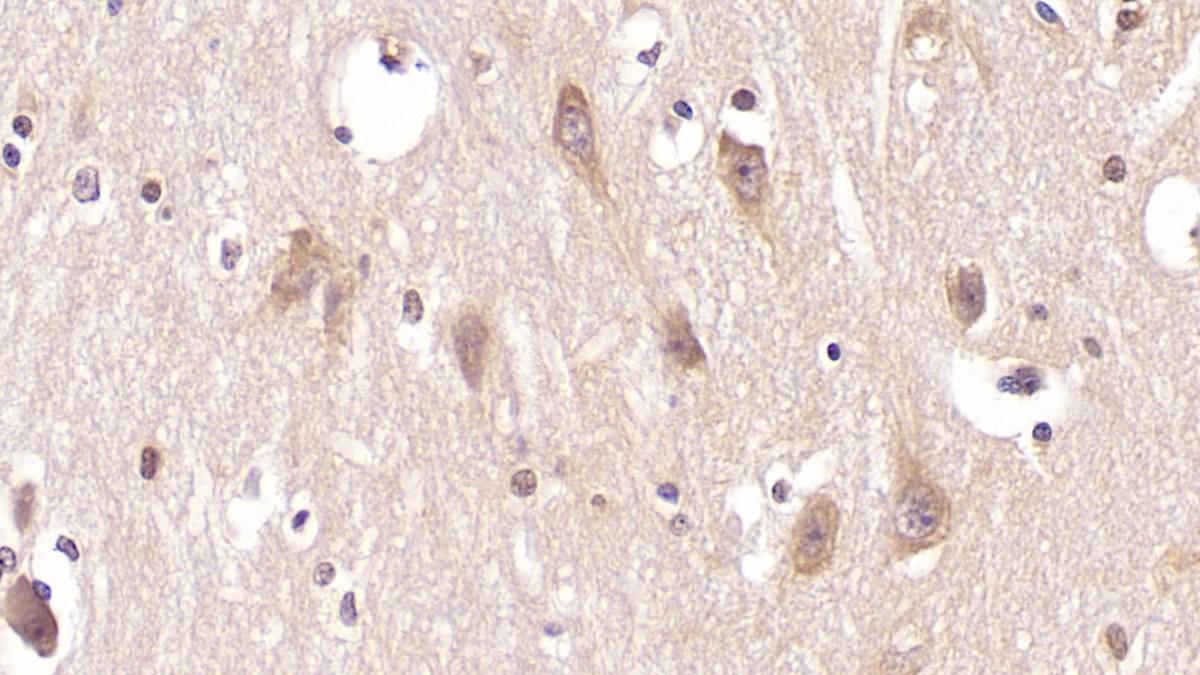 Monoclonal Antibody to Parathyroid Hormone Receptor 2 (PTHR2)