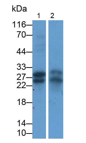 Monoclonal Antibody to Cardiac Troponin I (cTnI)