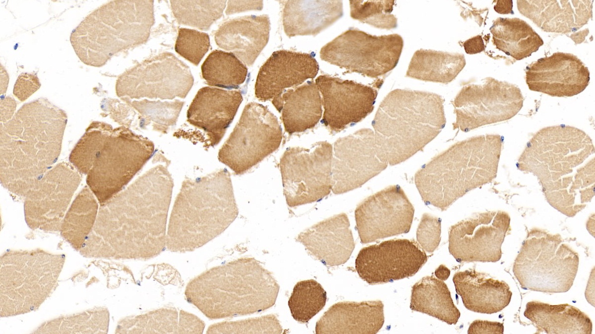 Monoclonal Antibody to Myoglobin (MYO)