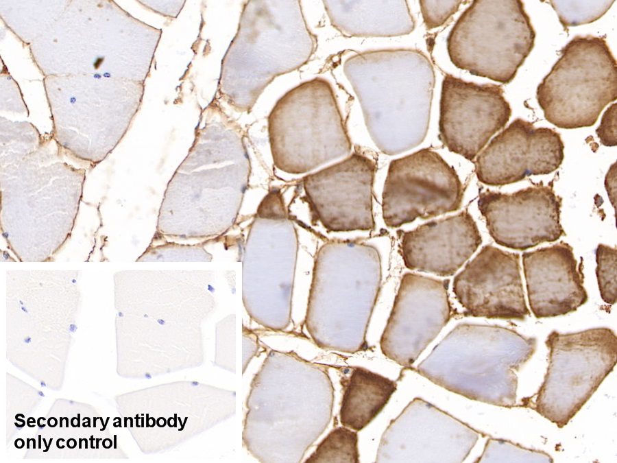 Monoclonal Antibody to Myoglobin (MYO)