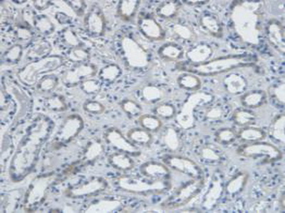 Monoclonal Antibody to Endothelin 1 (EDN1)