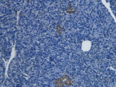 Monoclonal Antibody to Endothelin 1 (EDN1)