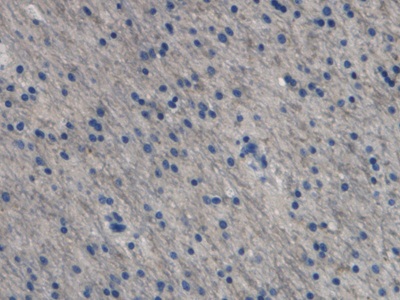 Monoclonal Antibody to Endothelin 1 (EDN1)