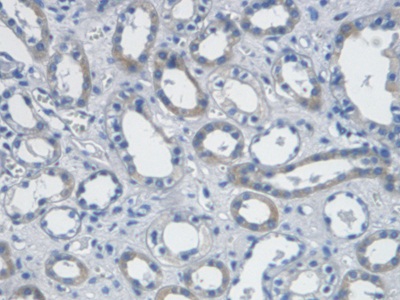 Monoclonal Antibody to Endothelin 1 (EDN1)