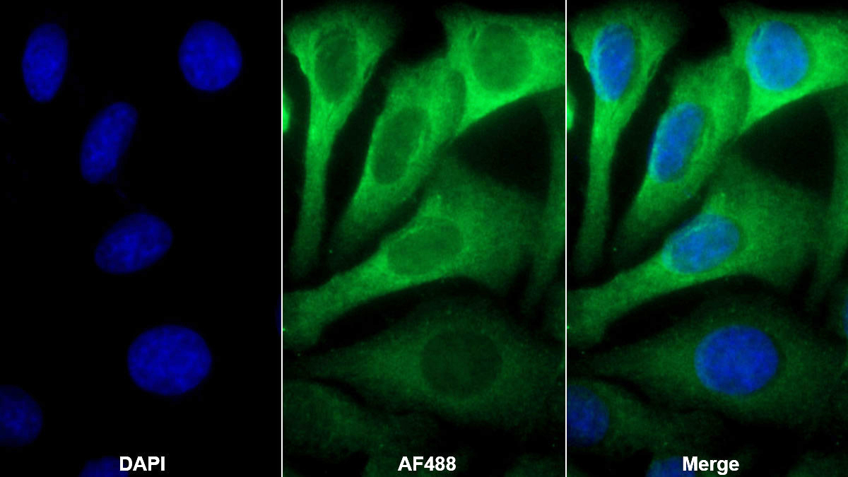 Monoclonal Antibody to Endothelin 1 (EDN1)