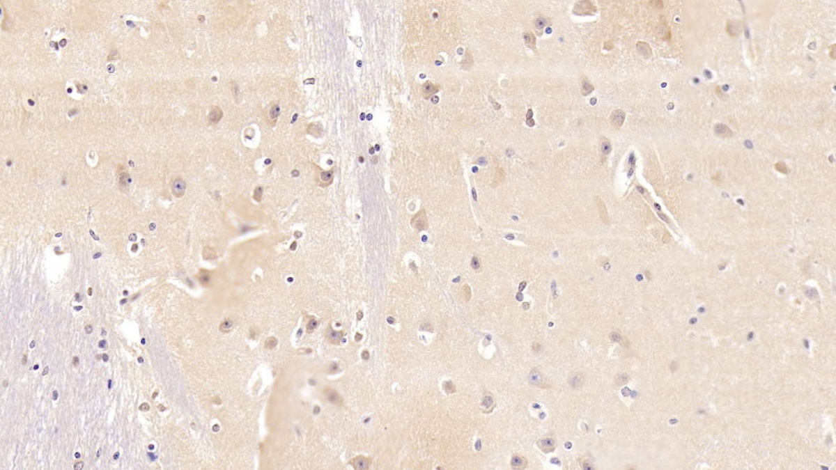 Monoclonal Antibody to N-Terminal Pro-Brain Natriuretic Peptide (NT-ProBNP)