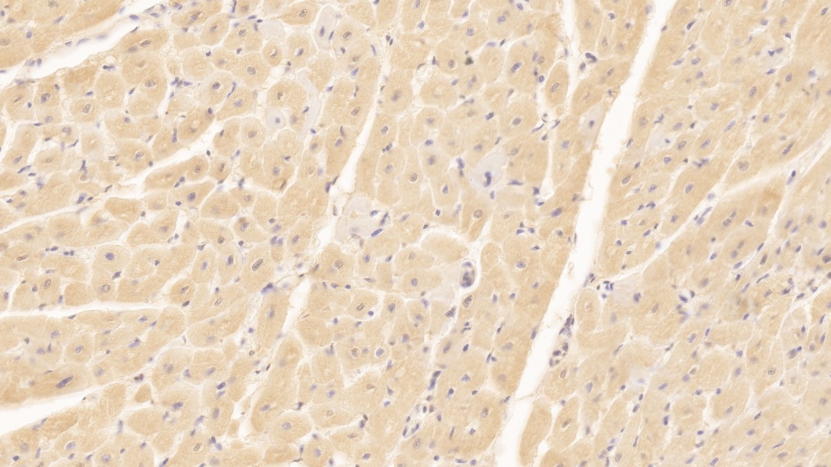 Monoclonal Antibody to N-Terminal Pro-Brain Natriuretic Peptide (NT-ProBNP)