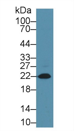 Monoclonal Antibody to N-Terminal Pro-Brain Natriuretic Peptide (NT-ProBNP)