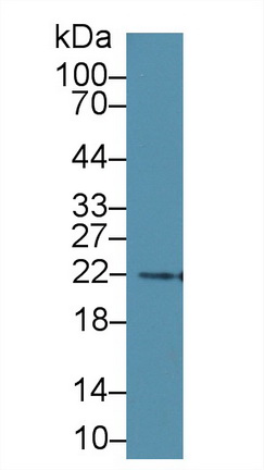 Monoclonal Antibody to N-Terminal Pro-Brain Natriuretic Peptide (NT-ProBNP)