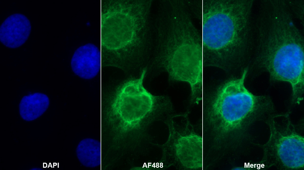 Monoclonal Antibody to N-Terminal Pro-Brain Natriuretic Peptide (NT-ProBNP)