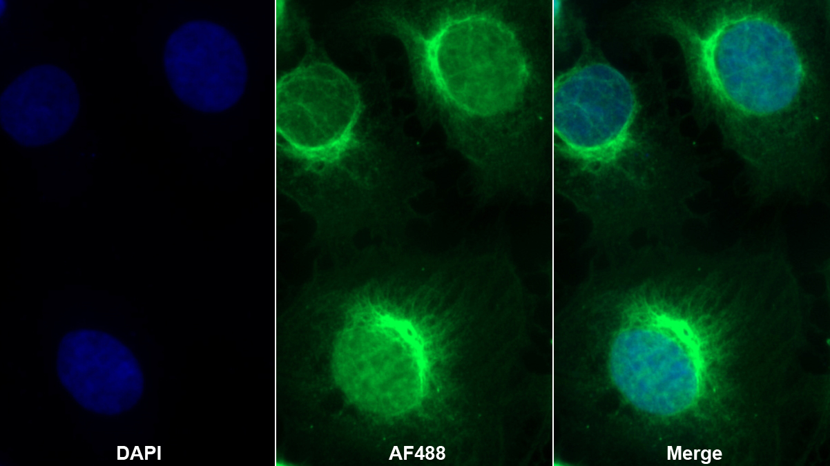 Monoclonal Antibody to N-Terminal Pro-Brain Natriuretic Peptide (NT-ProBNP)