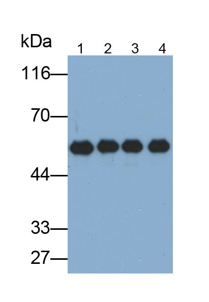 Monoclonal Antibody to Cytokeratin 4 (CK4)