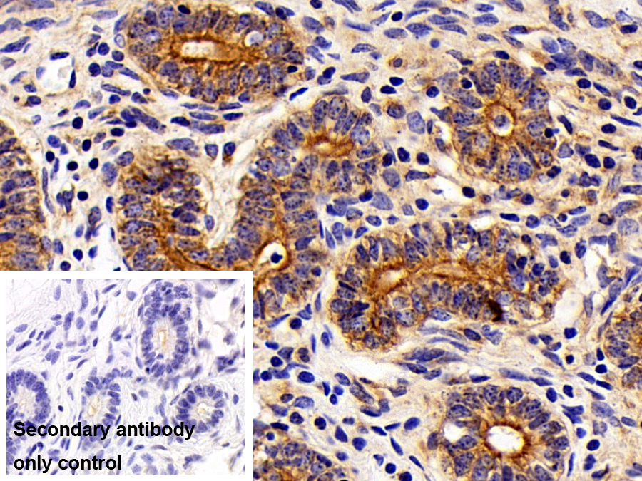 Monoclonal Antibody to Cytokeratin 4 (CK4)