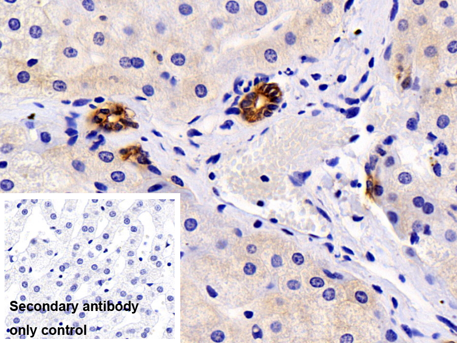 Monoclonal Antibody to Cytokeratin 4 (CK4)