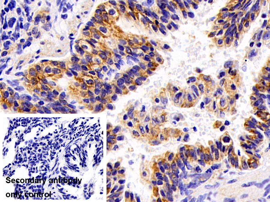 Monoclonal Antibody to Cytokeratin 4 (CK4)