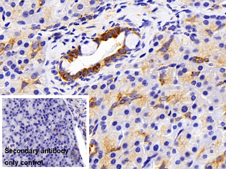 Monoclonal Antibody to Cytokeratin 4 (CK4)