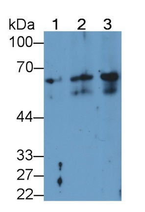 Monoclonal Antibody to Keratin 2 (CK2)