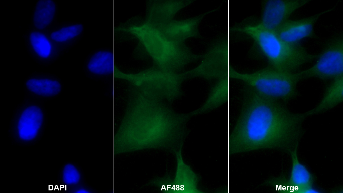 Monoclonal Antibody to Nestin (NES)