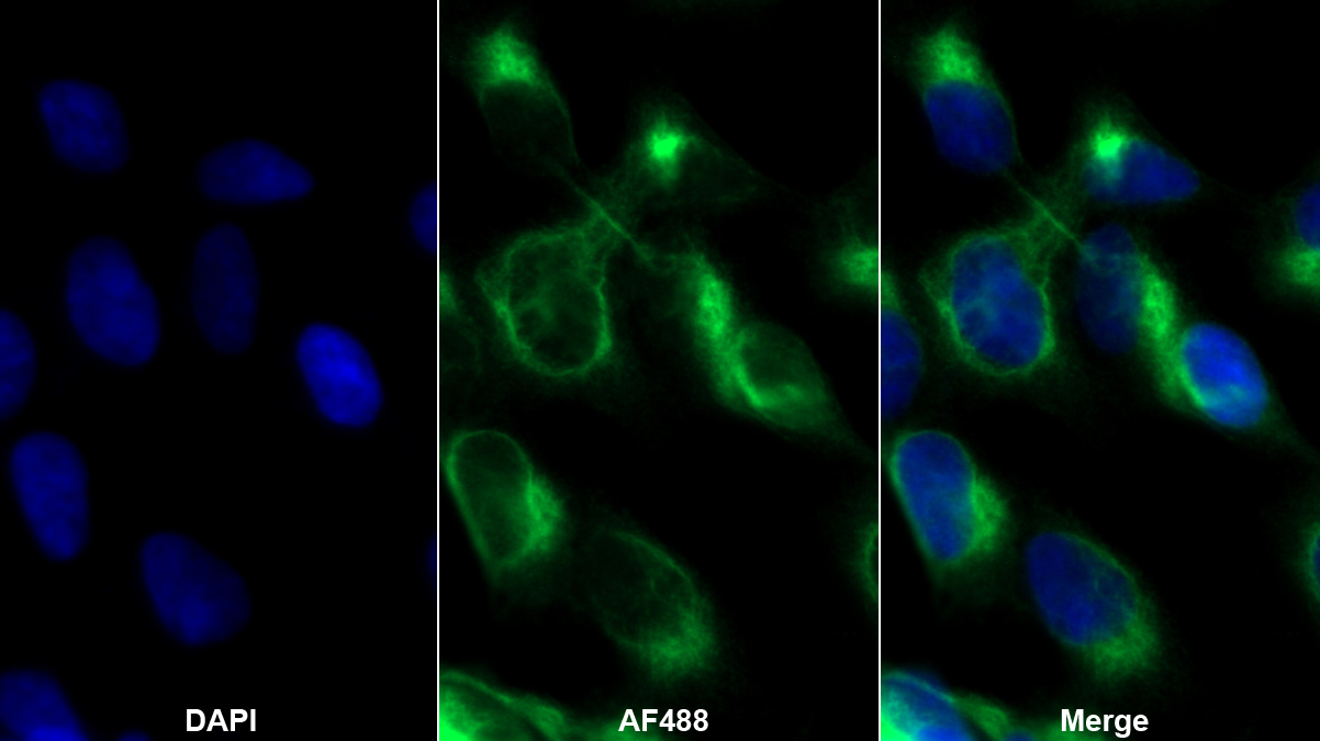 Monoclonal Antibody to Nestin (NES)