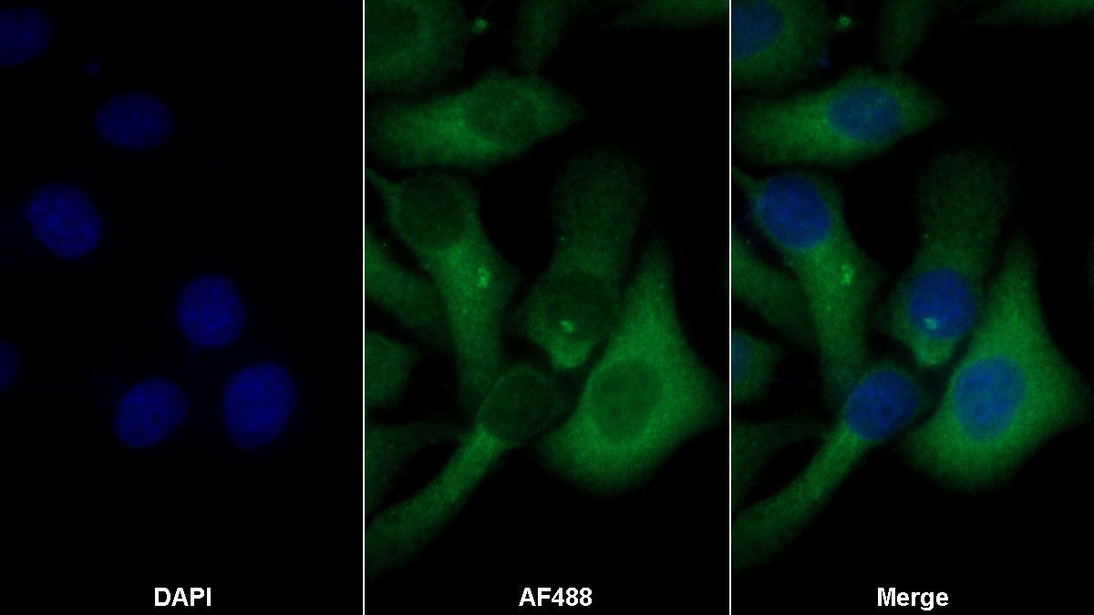 Monoclonal Antibody to Nestin (NES)