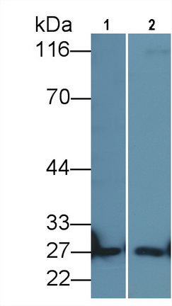 Monoclonal Antibody to Apolipoprotein A1 (APOA1)