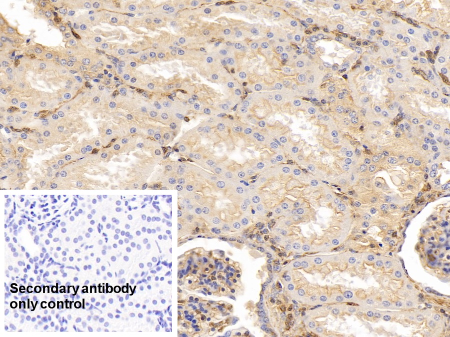 Monoclonal Antibody to Apolipoprotein A1 (APOA1)