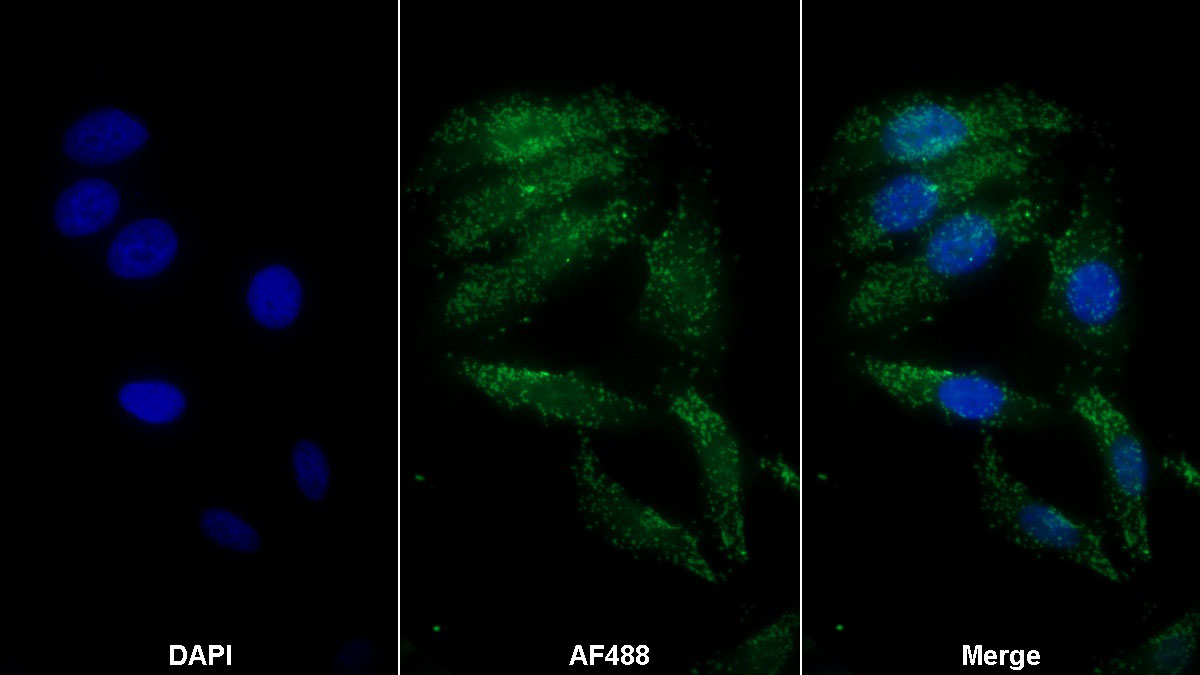 Monoclonal Antibody to Apolipoprotein A1 (APOA1)