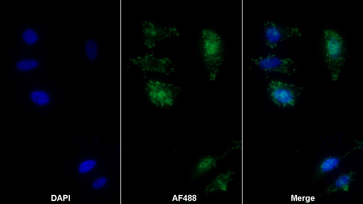 Monoclonal Antibody to Apolipoprotein A1 (APOA1)