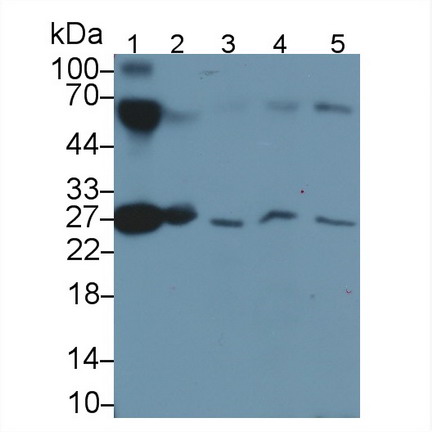 Monoclonal Antibody to Apolipoprotein A1 (APOA1)