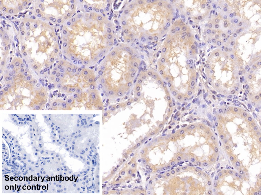 Monoclonal Antibody to Apolipoprotein A1 (APOA1)