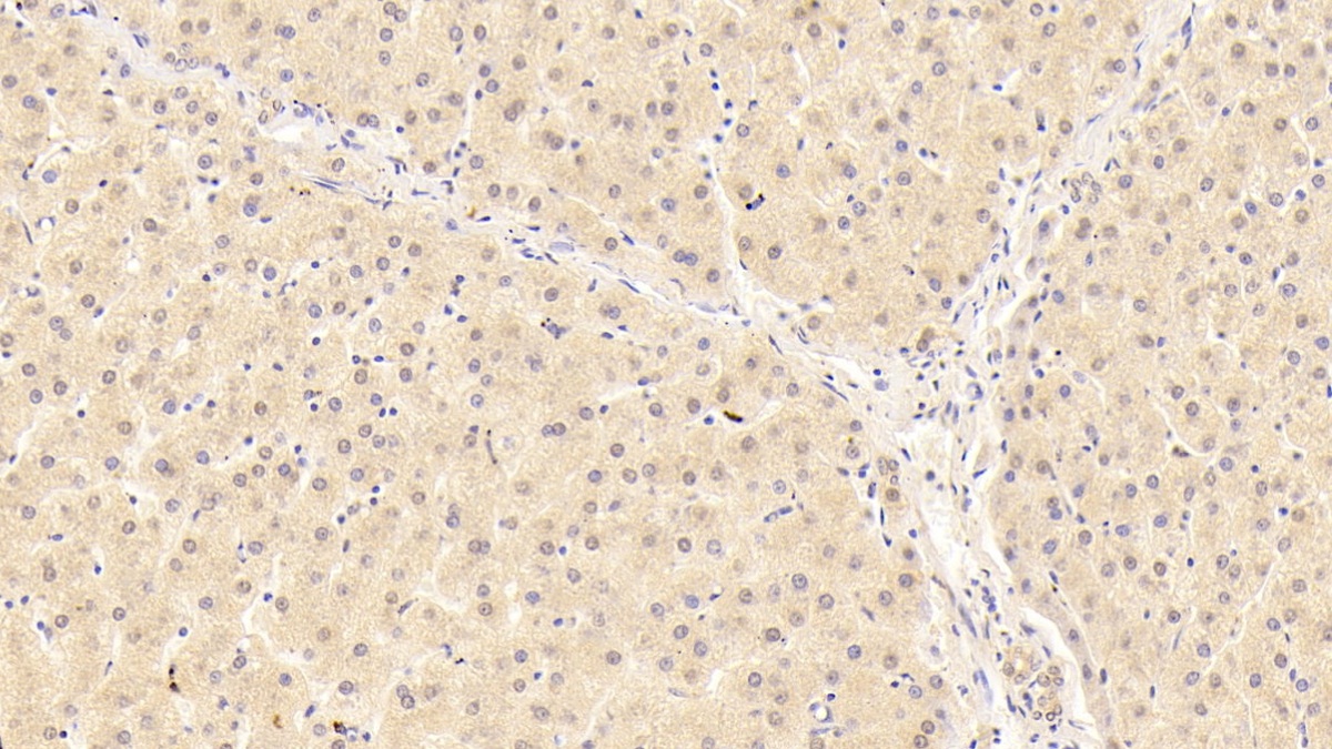 Monoclonal Antibody to Apolipoprotein A1 (APOA1)