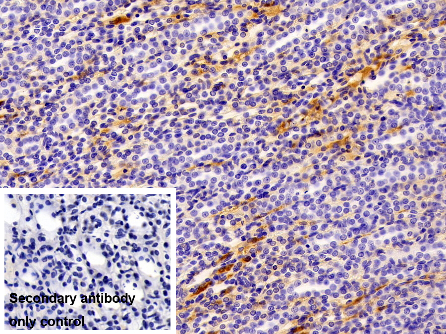 Monoclonal Antibody to Apolipoprotein A1 (APOA1)