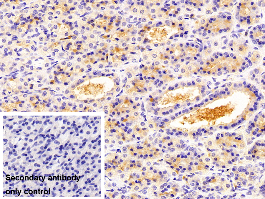 Monoclonal Antibody to Apolipoprotein A1 (APOA1)