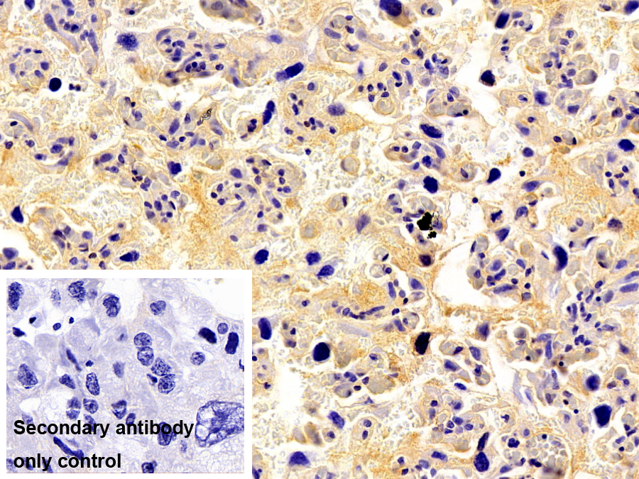 Monoclonal Antibody to Apolipoprotein A1 (APOA1)