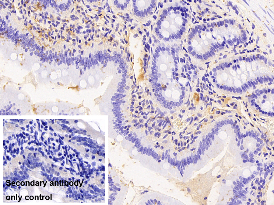 Monoclonal Antibody to Apolipoprotein A1 (APOA1)