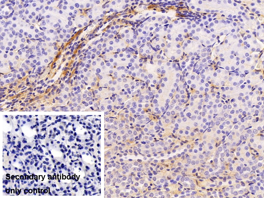 Monoclonal Antibody to Apolipoprotein A1 (APOA1)