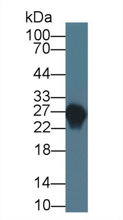 Monoclonal Antibody to Apolipoprotein A1 (APOA1)