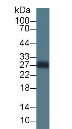 Monoclonal Antibody to Apolipoprotein A1 (APOA1)