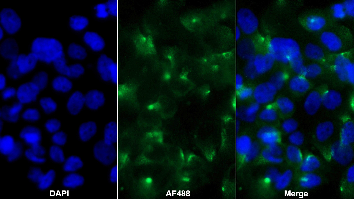 Monoclonal Antibody to Tissue Factor (TF)