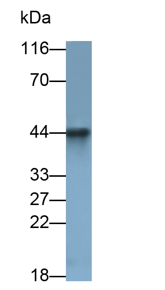 Monoclonal Antibody to Tissue Factor (TF)